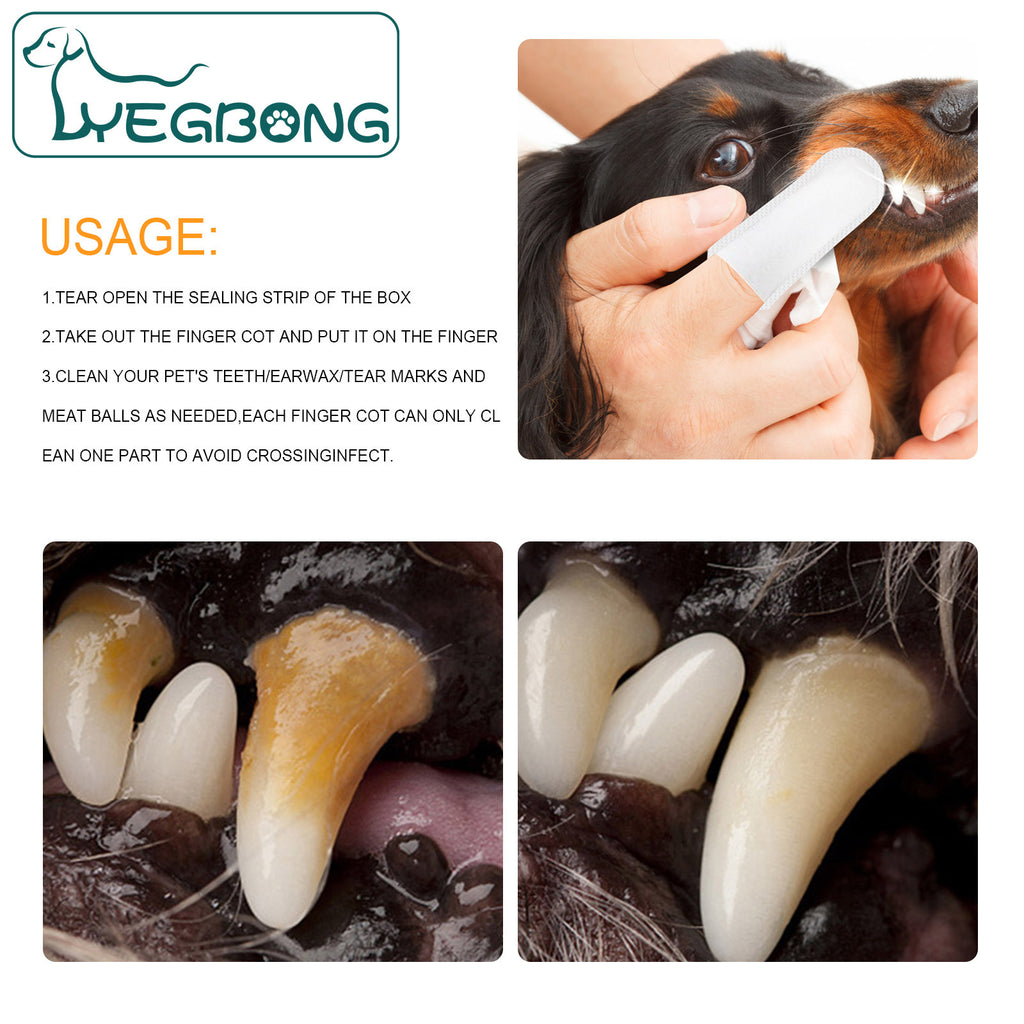 Dental finger wipes ingredients and benefits